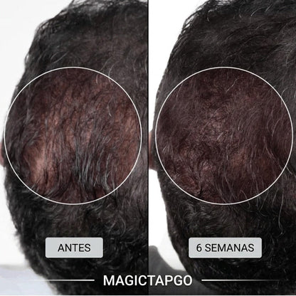 Magictapgo Gorra de Terapia de Luz Roja para Tratamientos de Crecimiento del Cabello