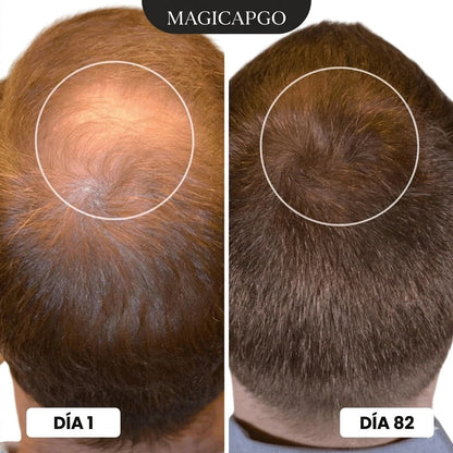 Magictapgo Gorra de Terapia de Luz Roja para Tratamientos de Crecimiento del Cabello