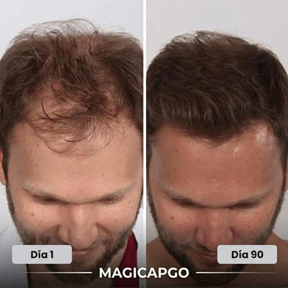 Magictapgo Gorra de Terapia de Luz Roja para Tratamientos de Crecimiento del Cabello